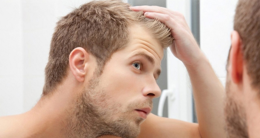 ریزش مو در اثر تغییر هورمونی