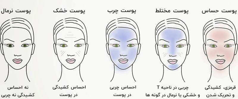 تشخیص نوع پوست