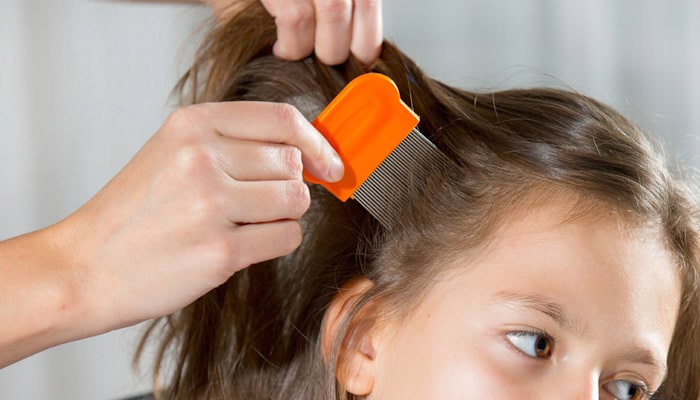 درمان خانگی شپش سر موی کودکان