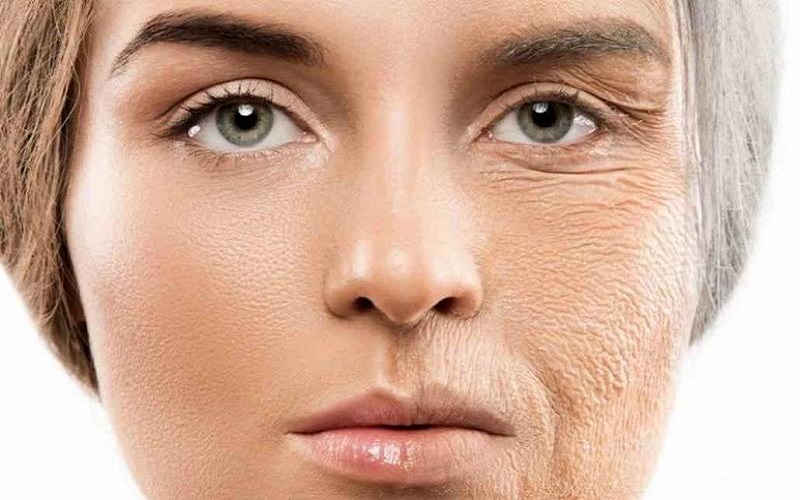 سیگار چه تاثیری بر روی پوست صورت دارد؟