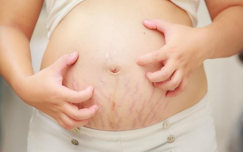 دلیل مشکلات پوستی در بارداری چیست؟