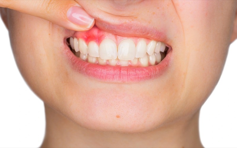 چطور در شب از دندان درد خلاص شویم؟